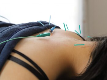 ドマイロ鍼灸院(Domairo鍼灸院)の写真/デスクワークや家事育児による体の負担に！血流アップで軽やかに！痛みの少ない鍼だから初めての方にも◎