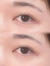 アテ(ate.)/アンドヘルシー80本