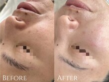 サロンブランシュ(salon BLANCHE)/CHRISTINA【くすみ・毛穴ケア】