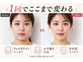 マイスター整体院 天神院の写真/小顔を目指すなら、先ずはフェイスラインです！【西鉄天神駅から徒歩3分】
