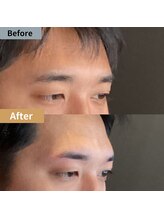 眉毛ハウス 吉祥寺店(眉毛HOUSE)/お客様の施術例(吉祥寺/東京)