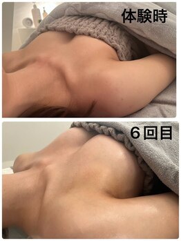 美人バスト 新宿店/☆姉妹店バストアップ症例写真☆