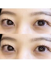 コレットアイビューティー(COLLET EYE BEAUTY)/