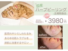 エピシア(Epicia)の雰囲気（お肌に優しい国産ハーブを使用したハーブピーリング！メンズも◎）