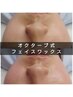 【新規】フェイスワックス＋美眉スタイリング〈冷やし+保湿付 ¥17500→¥12000