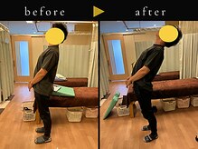 杉本接骨鍼灸院/背骨から全身がユルユル整体