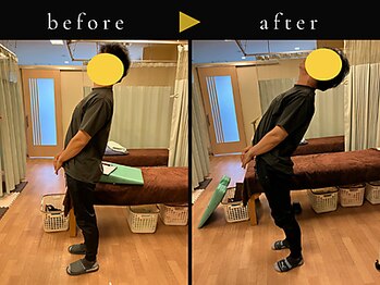 杉本接骨鍼灸院/背骨から全身がユルユル整体