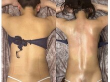 アーネスト(EARNEST)/目指せ、背中美人！！