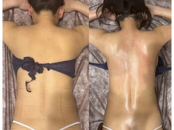 アーネスト(EARNEST)/目指せ、背中美人!!