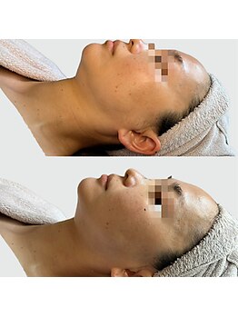 アズユウ(As U)/タラソトリートメント