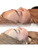 透明感UP！【フェイシャルＷＡＸ】お顔の産毛・古い角質をとり、ワントーン明るいもちもちツヤツヤ肌に◎