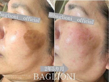 メディカルサロン バリオーニ/2023年肌改善セミファイナリスト