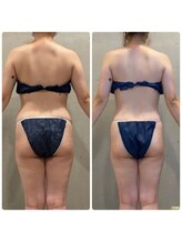 エクセレントビューティーサロン 艶(EN)/減量プログラム　４回