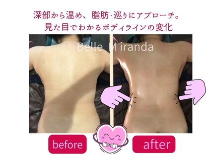エステティック ベルミランダの写真