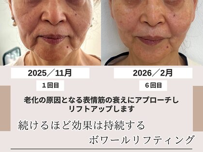 ミラーレ(Mirare)の写真