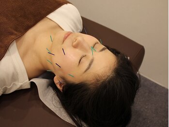 【美容鍼・ダイエット】メリとハリ　阿倍野店の写真/小顔＝エステのイメージを覆す！鏡を見るのが楽しくなる！美容鍼だから出来るむくみ/肌荒れトータルケア！