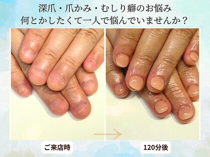 ブルームーンネイルズ(BLOOMOON.nails)の写真