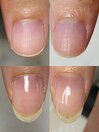 お客様Before after
