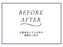 ニキビケア研究所 天王寺 阿倍野店/BEFORE AFTER