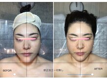 自然美人/小顔コルギの効果