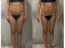 アーネスト(EARNEST)/劇的変化！産後ダイエットに