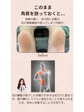 プルーヴ(PROVE)/爪整体が育む足元からの健康