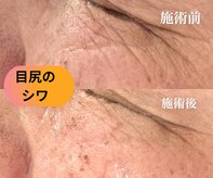 ルアーナ(Luana)