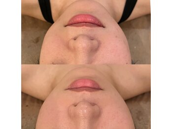 ラドンナ(LA DONNA)/脂肪量を調節しサイズダウン