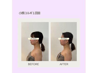 ヴィオルネ(VIE ORNER)の写真