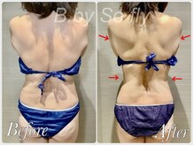 ビードット バイ ソーフライ(B.by So fly)/オーダーメイド痩身で脂肪分解！