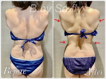 ビードット バイ ソーフライ(B.by So fly)/オーダーメイド痩身で脂肪分解！