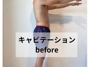 グラット(GLATT)/