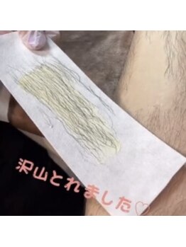 アンヴィオ ギンザコウフ(Anvio GINZA KOFU)/メンズワックス脱毛 【脚】