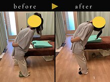 杉本接骨鍼灸院/背骨から全身がユルユル整体