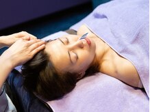 シー バイ カリスタ 池袋店(C by CALISTA)/ハリネズミ美容鍼で肌質改善