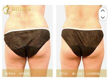 ビジュープラス 幸手店(Bijou+)/ビジリス 30代 週1～2回・2ヶ月