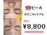 【毛穴ならこれ】私の悩みこれで改善！韓国肌管理ララピール¥13,200→