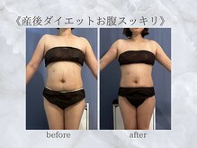 ジュプン 長崎/産後4ヶ月でご来店！