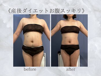 ジュプン 長崎/産後4ヶ月でご来店！