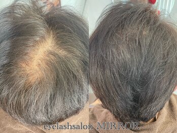 ミラー(MIRROR)/増毛エクステ/熊本/ボリューム