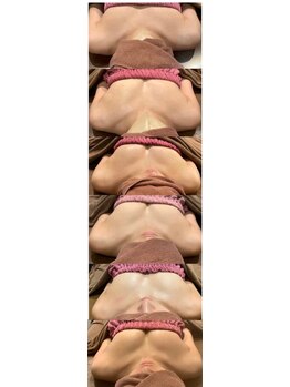 ロココ 豊田店(Rococo)/ビフォーアフター