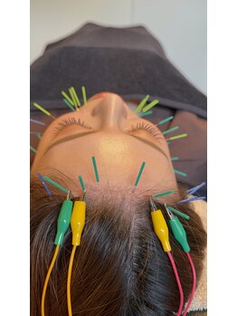 メディカルジャパン 吉祥寺/美容鍼灸