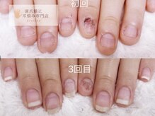 グレースレディ 神戸北店/