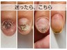 【迷ったらコレ】男女OK◎カウンセリング＋当日施術☆最適メニューをご案内