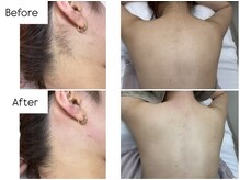 39 beauty salon.横浜関内【WAX脱毛/メンズ眉毛/水素吸入しながら】の雰囲気（加工なしで清潔感&トーンアップ!Wax後のツルツル体感ください♪）