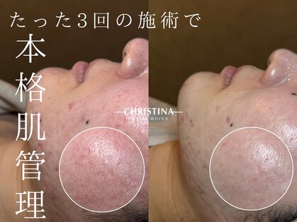 ルーツリー(Rootree)の写真