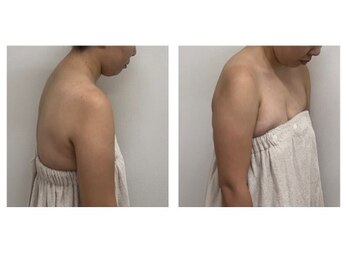 ジェム鍼灸サロン 横浜元町(gem鍼灸サロン)/姿勢が悪いことのデメリット