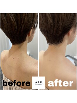 アプ(APP.)/脱毛/うなじ/襟足/シェービング