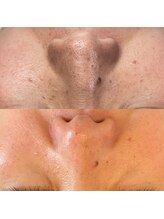 キキ(kiki)/１回の効果