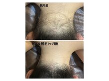 エンジェルワックス 川崎店(Angel Wax)の雰囲気（1回のダブル脱毛でしっかり効果を実感♪）